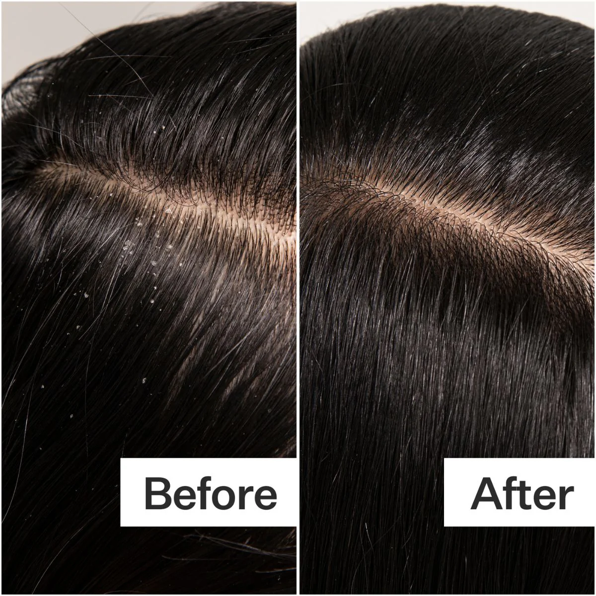 Act+Acre Cold Pressed Scalp Detox 89ml - Image 4