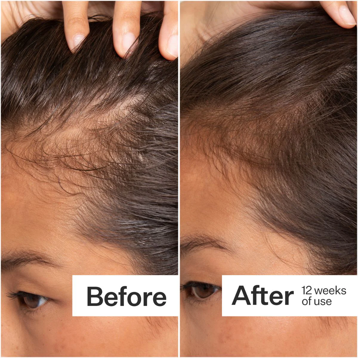 Act+Acre Cold Pressed Stem Cell Serum 65ml - Image 3