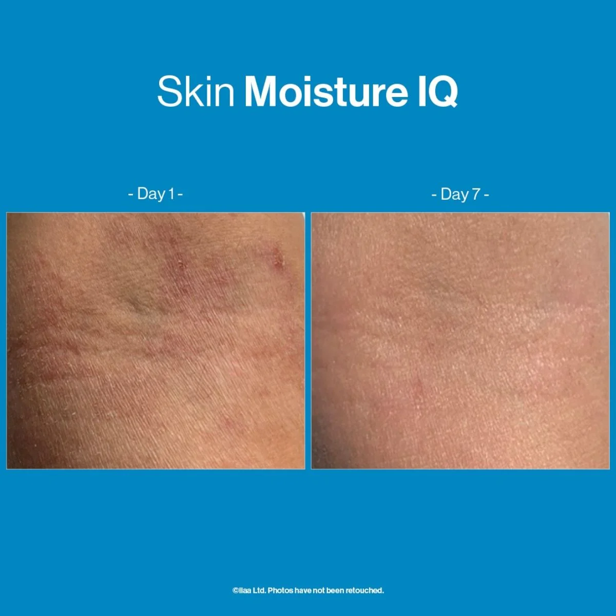 Advanced Nutrition Programme Skin Moisture IQ - Image 2