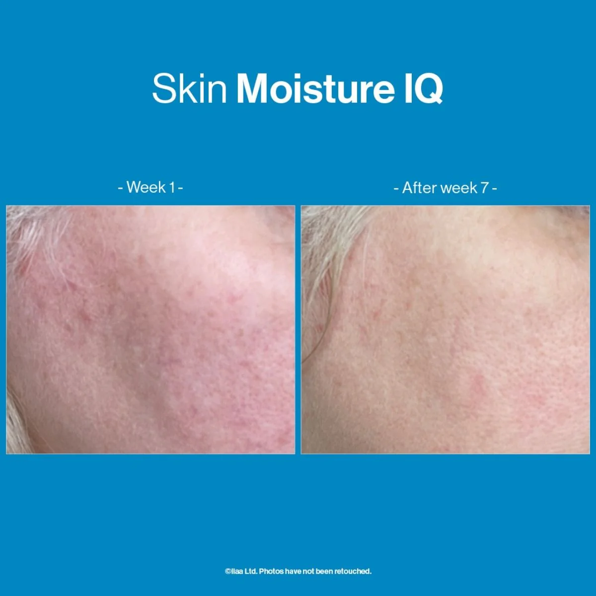 Advanced Nutrition Programme Skin Moisture IQ - Image 3