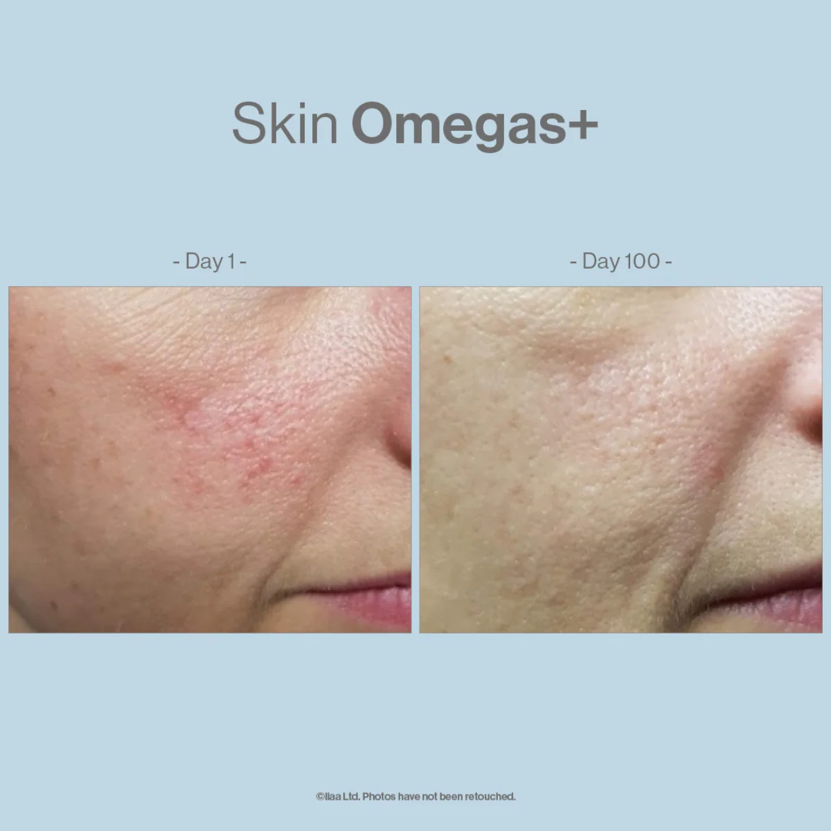 Advanced Nutrition Programme Skin Omegas+ 180 Caps - Image 3