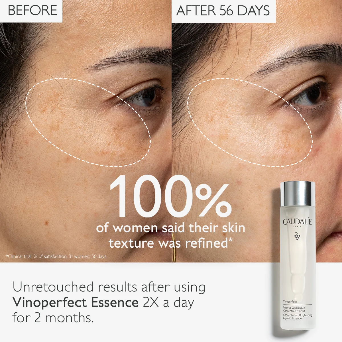 Caudalie Vinoperfect Concentrated Glycolic Essence - Image 6