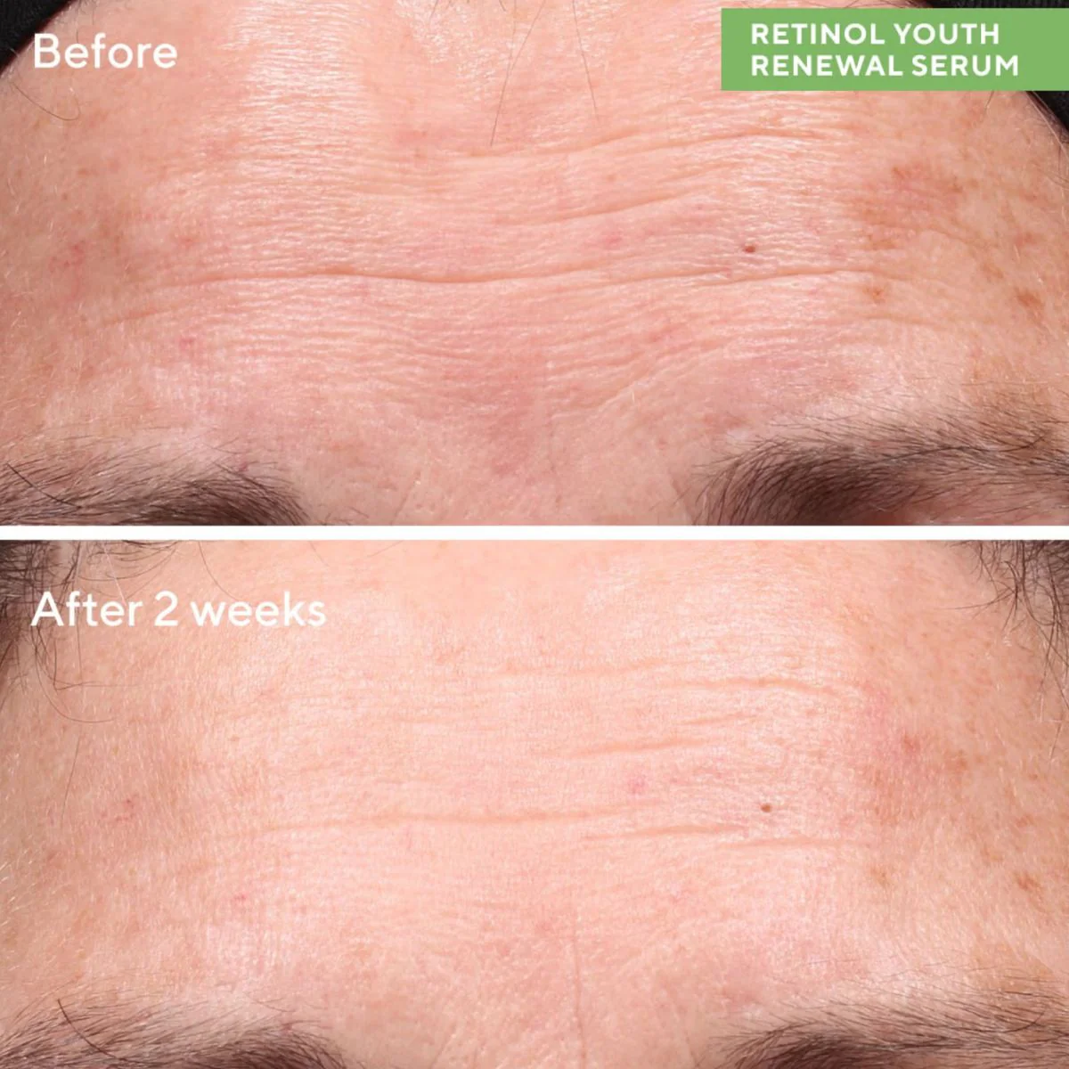 Murad Resurgence Retinol Youth Renewal Serum - Image 4