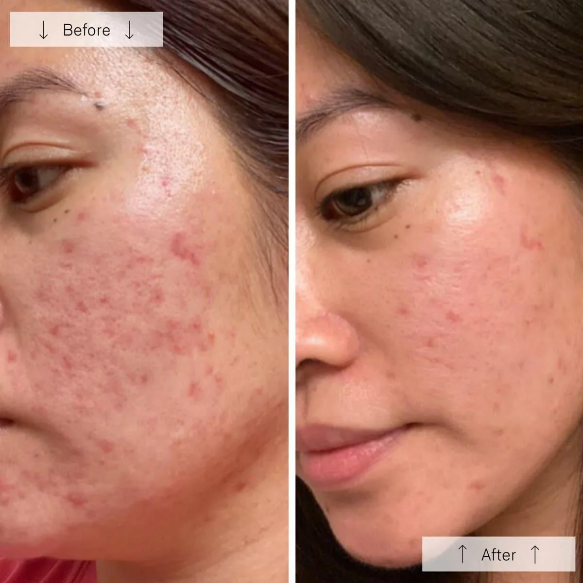 OMNILUX Clear LED Face Mask - Image 2