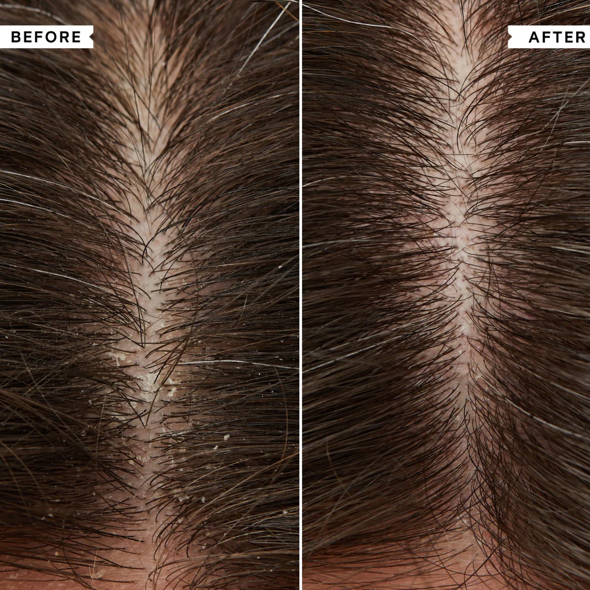 Philip Kingsley Healthy Hair And Scalp Kit - Image 3