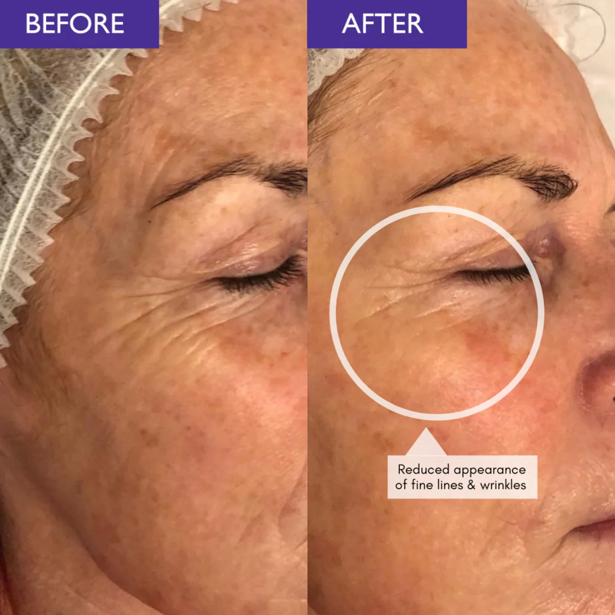 Skinician Ageless Peptide Eye Complex - Image 2