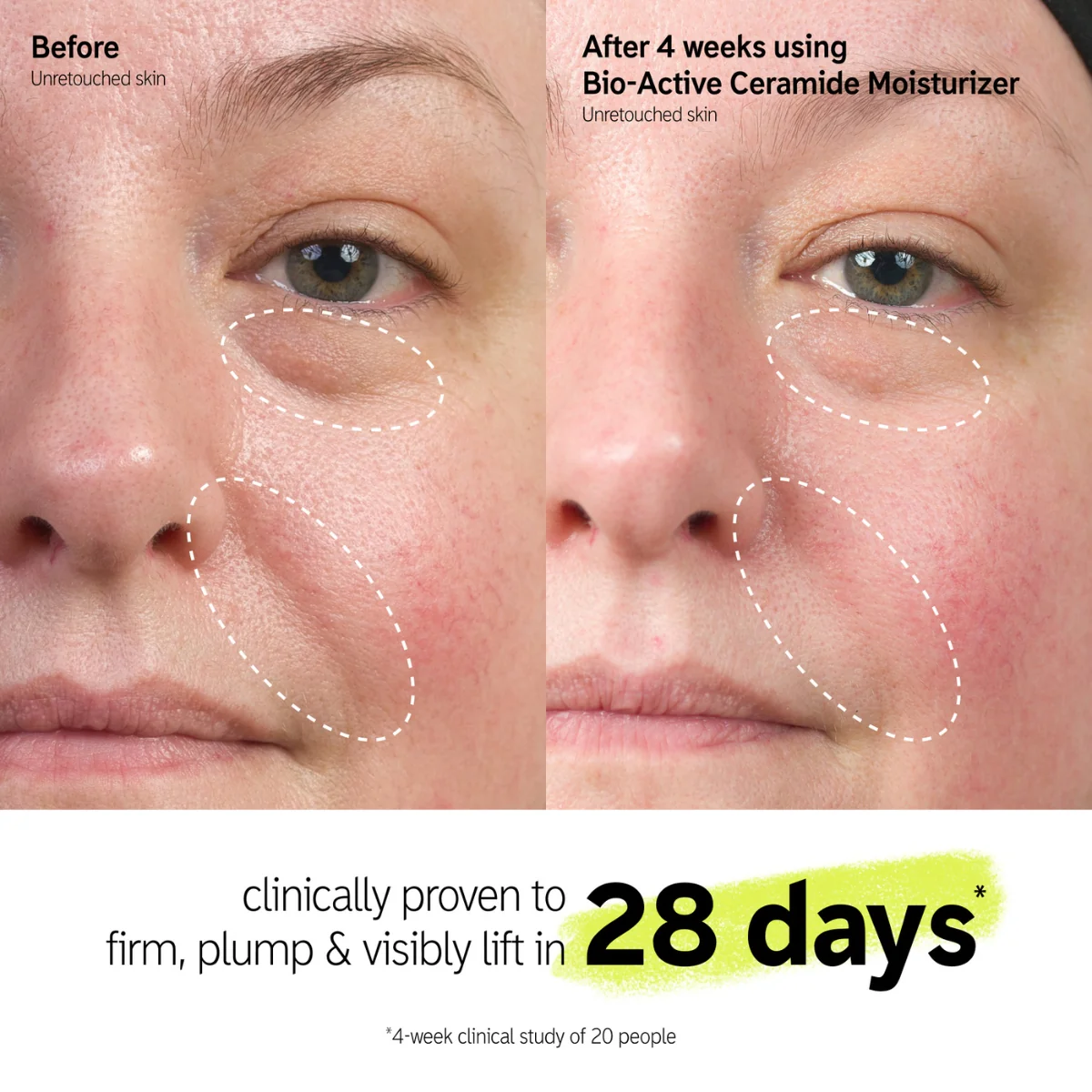 The Inkey List Bio-Active Ceramide Repairing and Plumping Moisturizer - Image 4