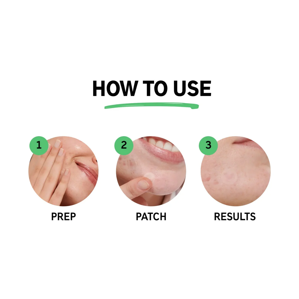 The Inkey List Hydrocolloid Pimple Patches - Image 4